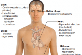 Foods that lowers blood pressure