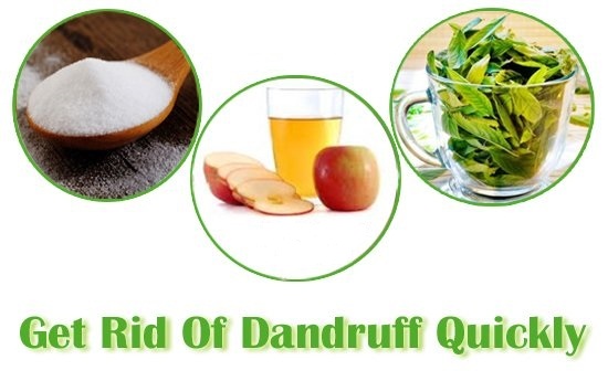 Home Treatment for dandruff treatment